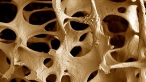 Osteoporose e Osteopenia na Fibrose Cística