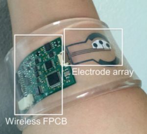 Pulseira com sensor de suor pode ajudar no diagnóstico da FC