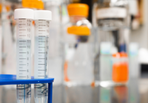 Teste do Suor específico identifica com maior precisão o efeito do Kalydeco na proteína CFTR